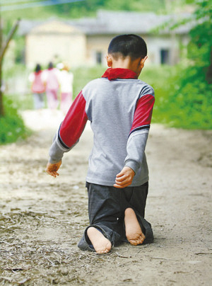 堅強少年天生殘疾以膝代步4年來堅持跪行上學