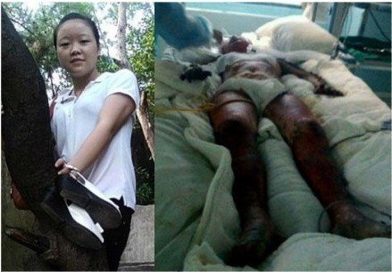 泉州汶川抗災(zāi)戰(zhàn)士疾呼：救救被大火燒傷的妹妹